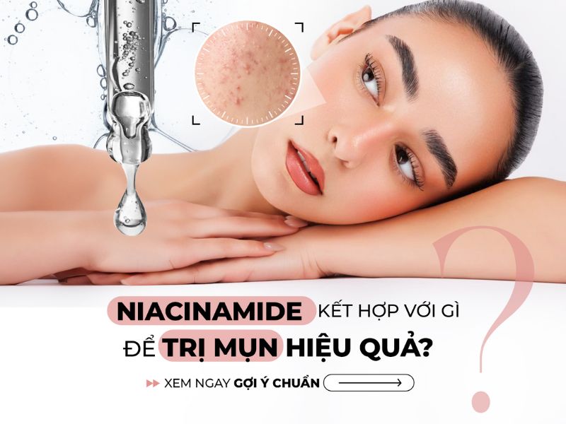 Niacinamide kết hợp với gì để trị mụn hiệu quả